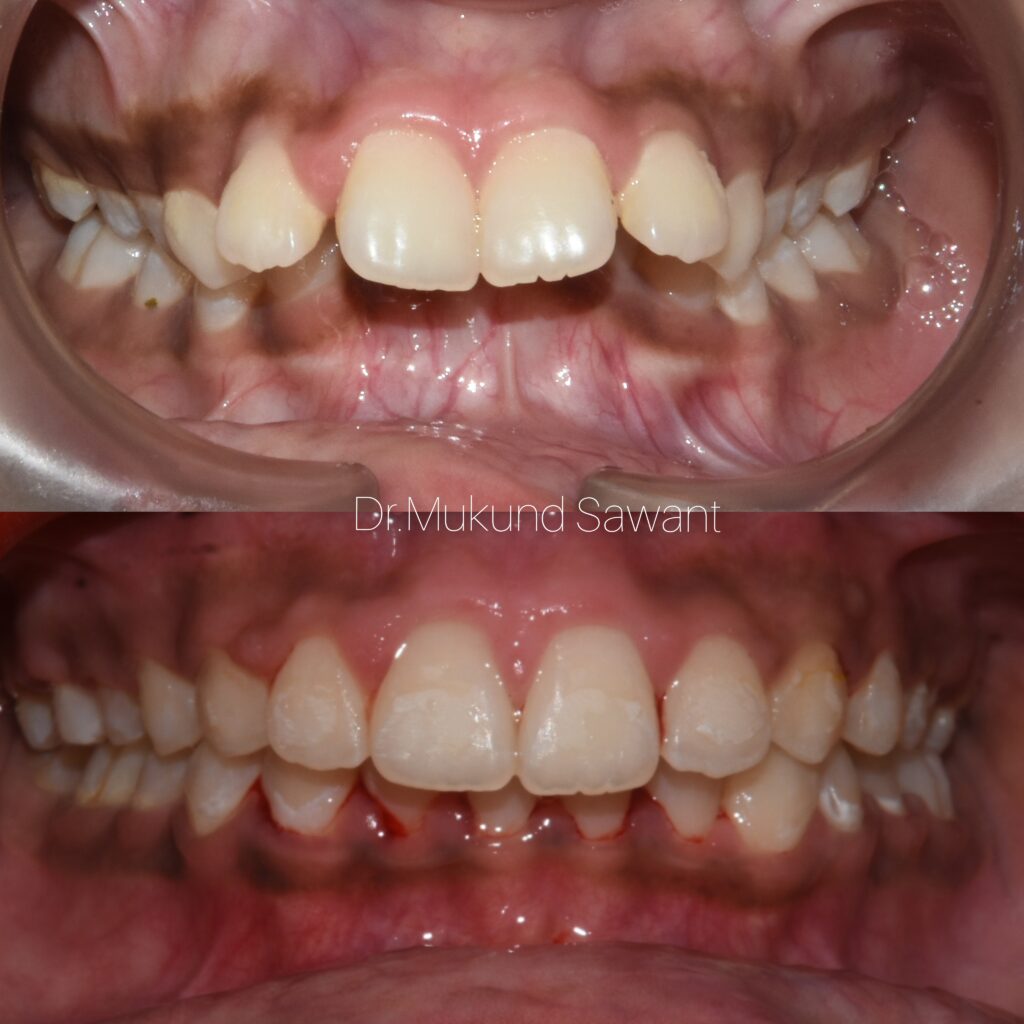 incollage 20240315 210749862