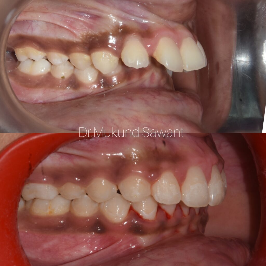 incollage 20240315 210924620