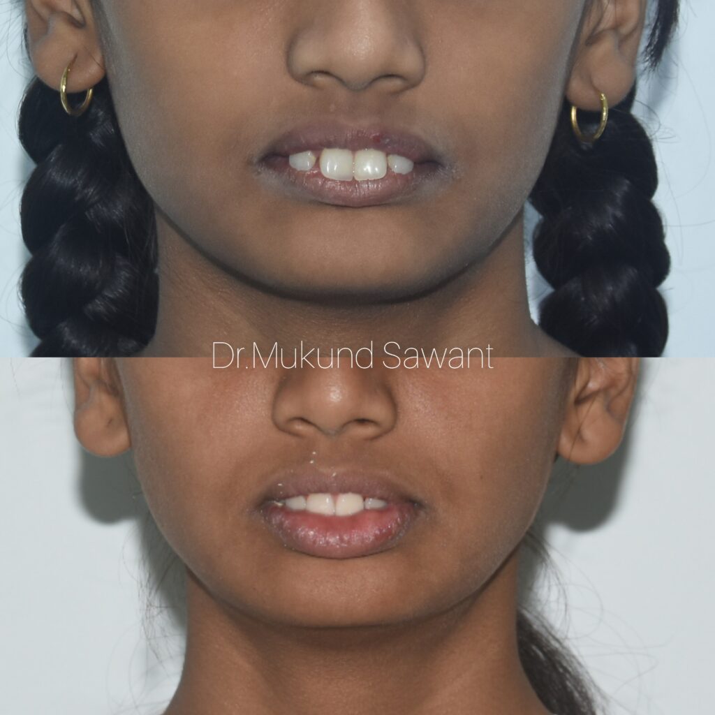 incollage 20240315 211123165