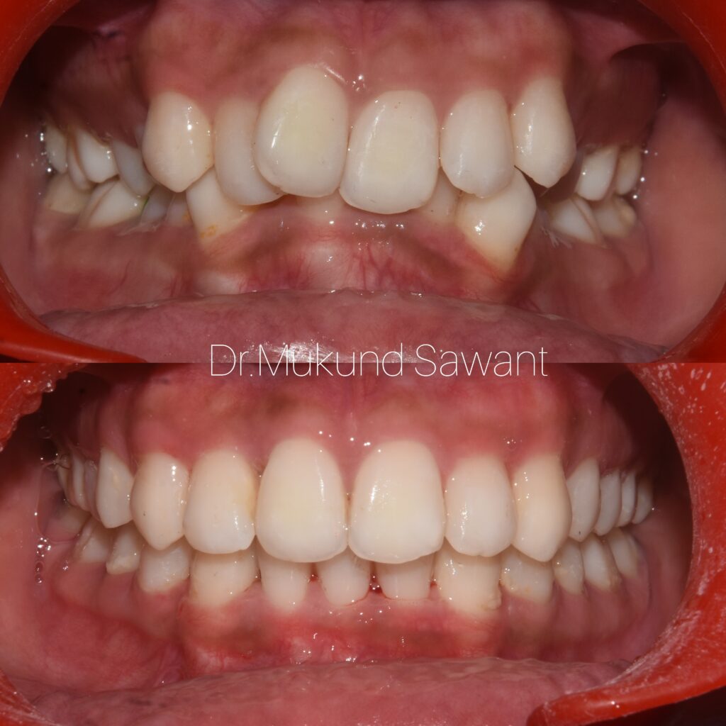 incollage 20240706 124844889