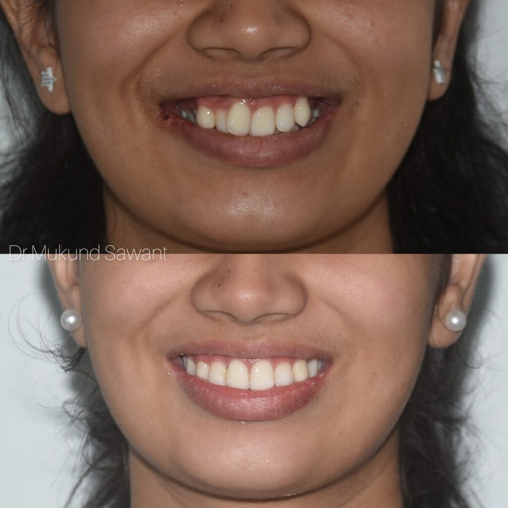 incollage 20240706 203237166