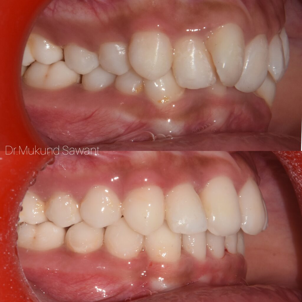 incollage 20240706 203811671