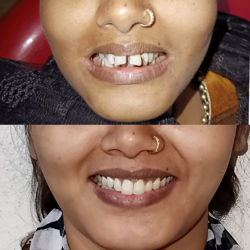 incollage 20241124 145027335