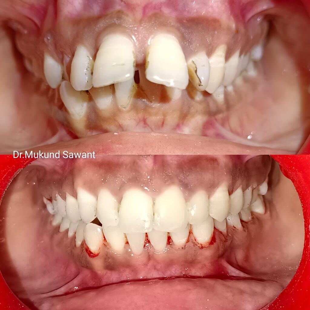 incollage 20241124 150301005